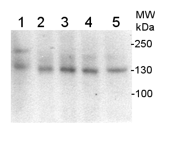 estern blot using ani-PFOR antibodies western blot using ani-PFOR antibodies