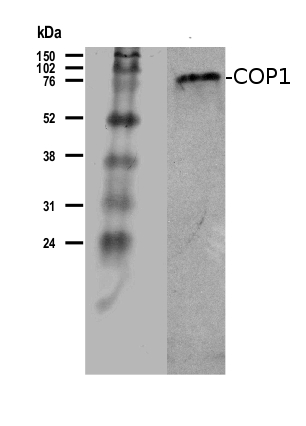 western blot using COP1 antibody