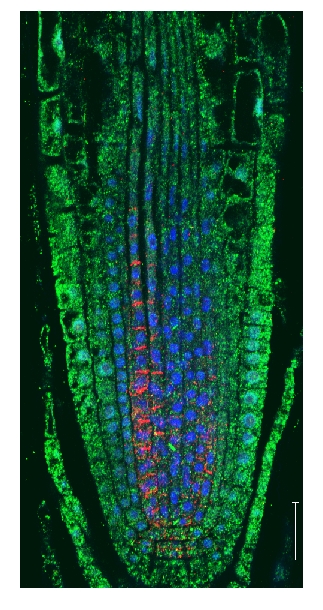 immunolocalization of COP1 in plant tissue