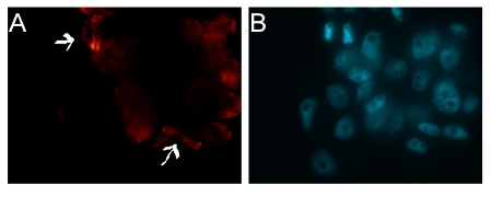 detection of plant tubulin in Arabidopsis suspenstion cells