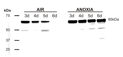 western blot detection of PDC in rice western blot detection of PDC in rice