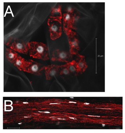 IF using plant anti-actin antibody IF using plant anti-actin antibody