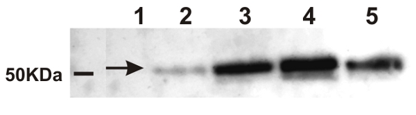 alpha-Ramy detection in rice using western blot
