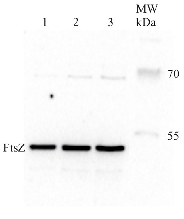 western blot using anti-procaryotic FtsZ antibody