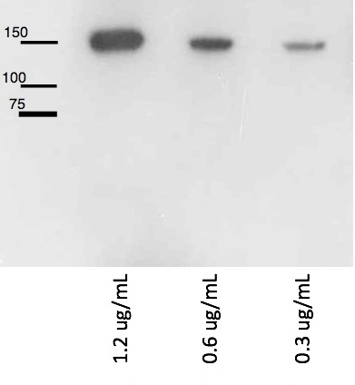 western blot using anti-LRIG1 rabbit antibody