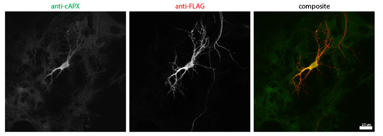 immunolocalization in high expressing neurons