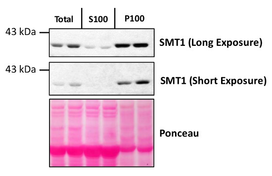 Western blot using anti-SMT1 antibodies