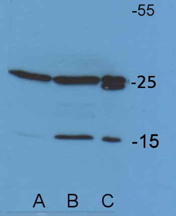 western blot using anti-Chlamydomonas Lhcb5 antibodies