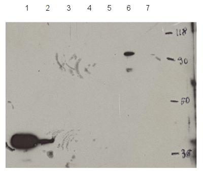 western blot detection of HDT1 (HD2A)