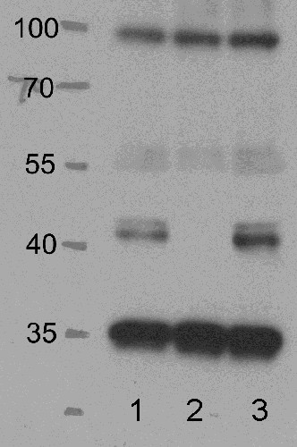 western blot using anti SnrK 2.2/3/6 antibody