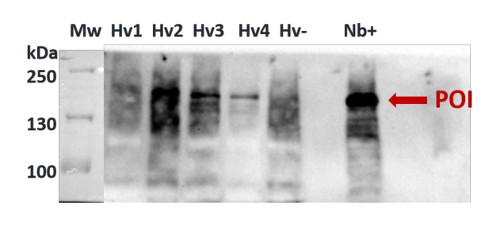 Western blot using polyclonal anti-Cas9 antibodies