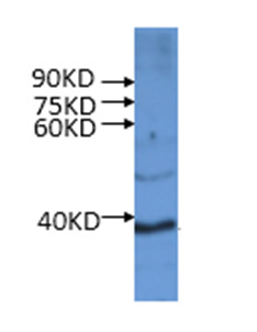 western blot using anti-WRKY antibodies