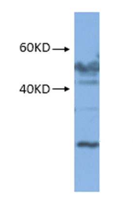 western blot using anti-RPS1 (mitochondrial) rabbit antibodies