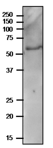 Western blot using anti-PYK10 (internal) antibodies
