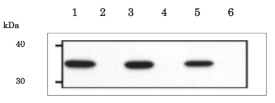 Western blot using anti-PBP1 antibodies