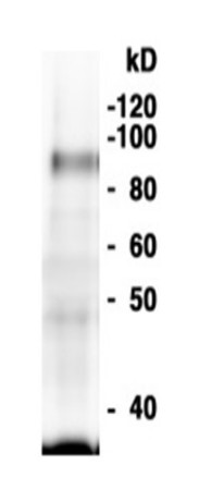 Western blot using anti-MEB2 antibodies