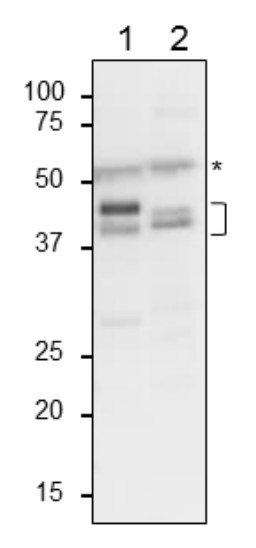 Western blot using anti-plant glutamine synthetase antibodies