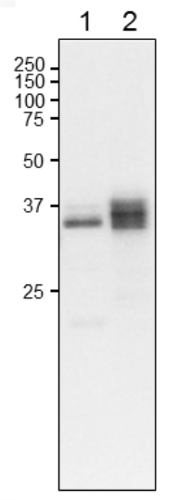 Western blot using anti- plant L-FNR2 antibodies
