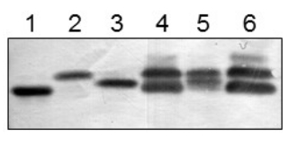 Western blot with anti-FNR1 antibodies on various cellular fractions