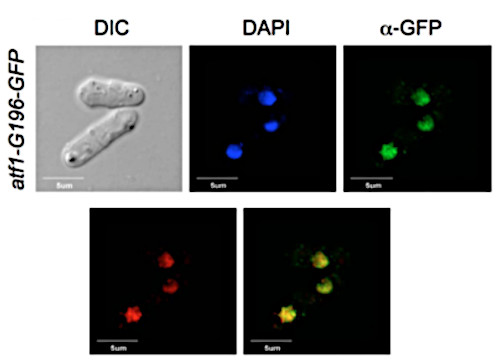Immunofluorescence using anti-GFP antibodies
