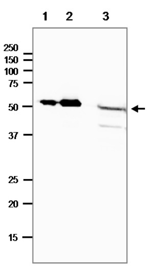 Western blot using anti-DNA photolyase (E.coli) antibodies