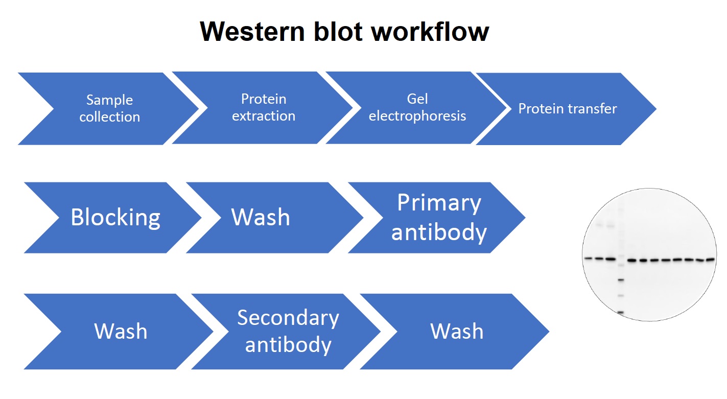Work flow in Western blot technique