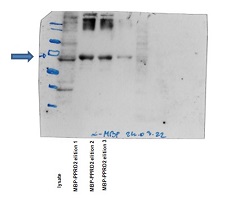 Anti-MBP | Maltose Binding Protein (monoclonal) antibodies