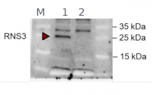 Lucifer Rns3 Anti-RNS3 | Ribonuclease 3 antibodies