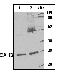 western blot