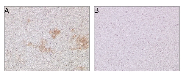 immunolocalization using Abeta monoclonal antibody