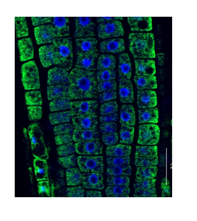 immunolocalization of plant BiP using hen antibody