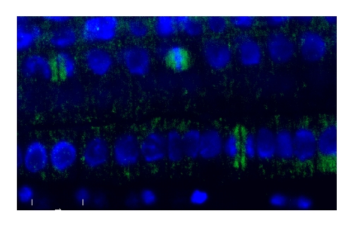 plant tubulin beta immunolocalization