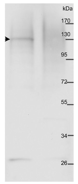 western blot using anti-PHOT1 antibodies