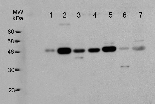 western blot using VTC2 antibodies