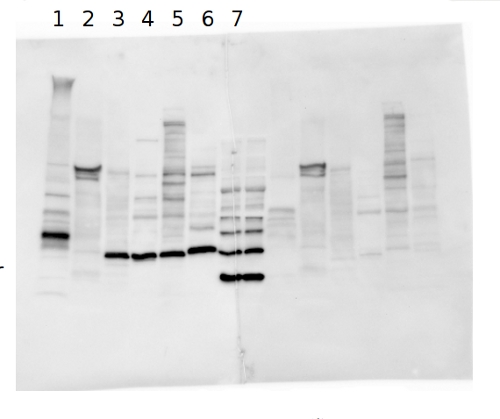 western blot using anti-DSP antibodies