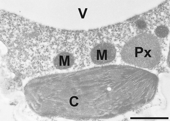 pre-immune serum control for anti-ACC antibody