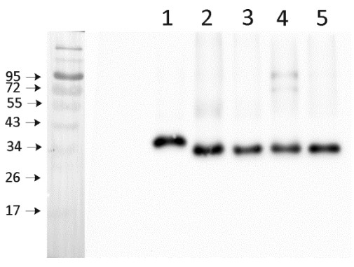 Western blot using anti-Lhcb5 antibodies