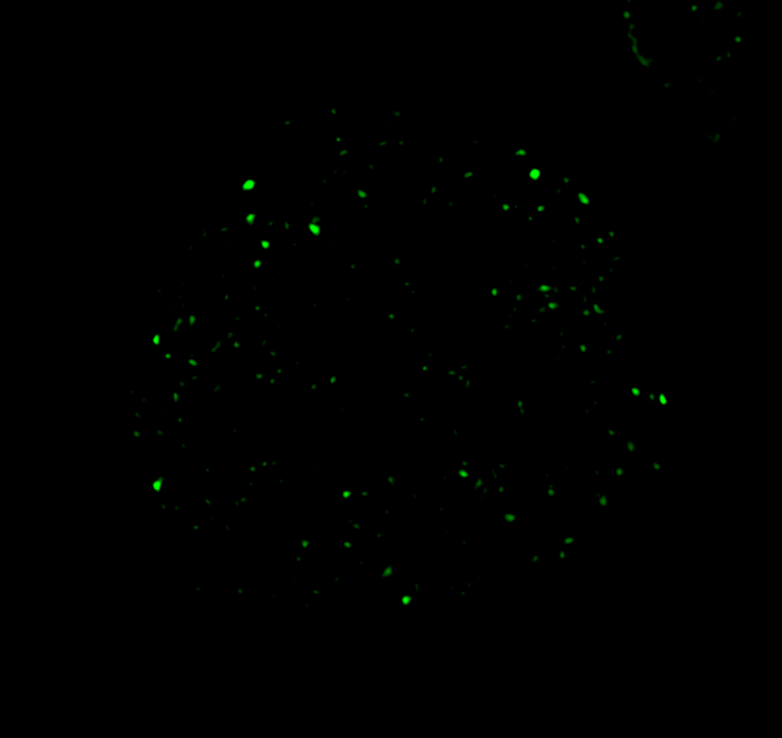 Immunofluorescence using anti-IDH antibodies