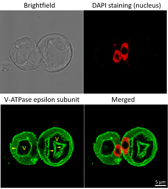Immunofluorescent localization of V-ATPase in rice protoplasts, using polyclonal antibodies