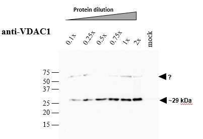 western blot using anti-VDAC1 antibodies