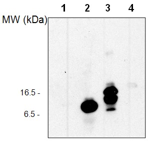 AS08 307 western blot ubiquitin.jpg