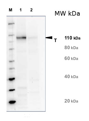 western blot with anti-NR antibodies