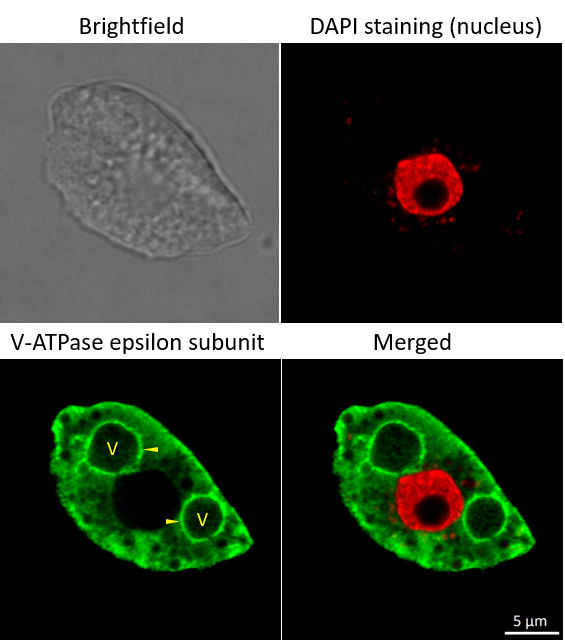 Immunofluorescent localization of V-ATPase epsilon subunit of tonoplast H+ATPase using goat anti-V-ATPase antibodies