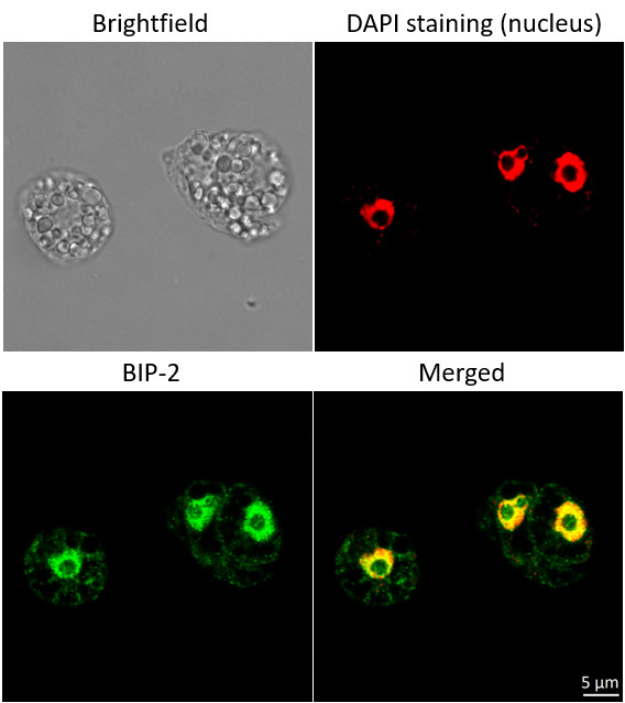 Immunofluorescent localization of BiP in suspension culture of Arabidopsis thaliana using anti-BiP goat polyclonal antibodies