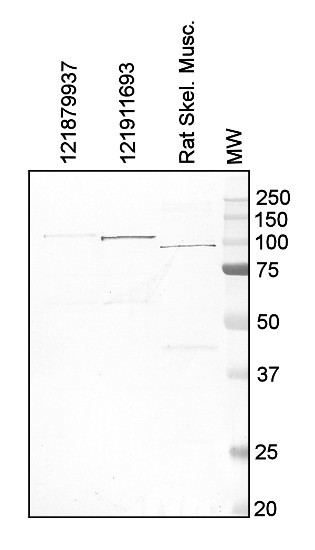 western blot using anti-glycogen phosphorylase antibodies used on T.vaginalis