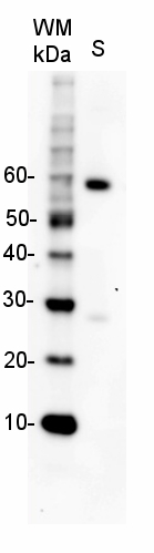 western blot using secondary antibody rabbit anti-goat immunoglobulins, HRP conjugated