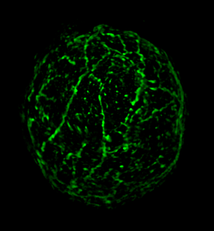 Fluorescent localization of plant actin