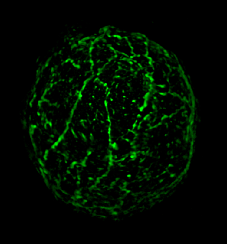 Fluorescent localization of plant actin in maize protoplasts