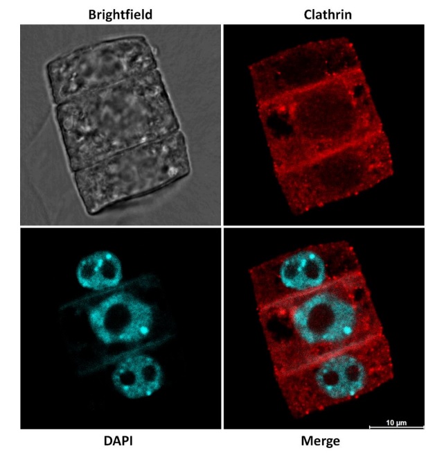 Immunofluorescent localization of clathrin in maize tissue