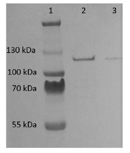 Western blot using anti-ADH/ALDH (bacterial, algal) antibodies